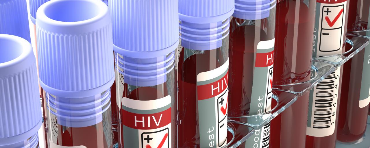 HIV blood vials shutterstock featured
