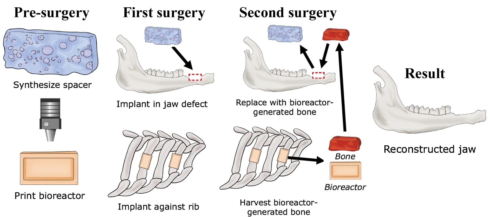 0318 JAW 1 web 2847vvl11