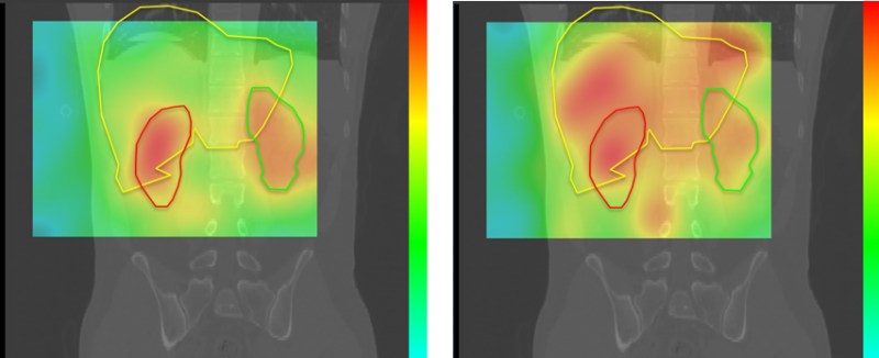 Under development medical camera could help cut time and cost of procedures 3 6551