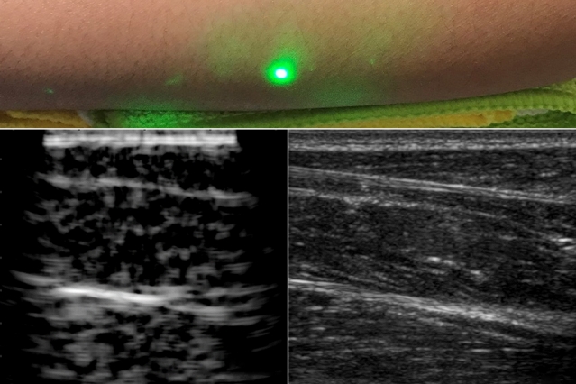 MIT Laser Ultrasound 1