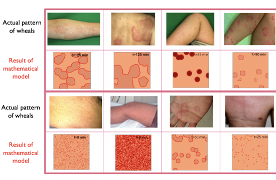 thumbnail figure hives