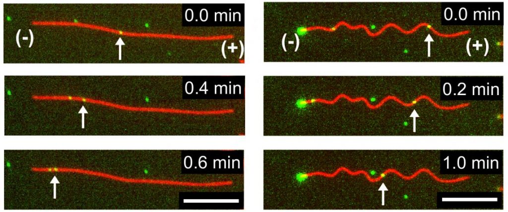 Cellular train track deformities shed light on neurological disease 3 microscopic images
