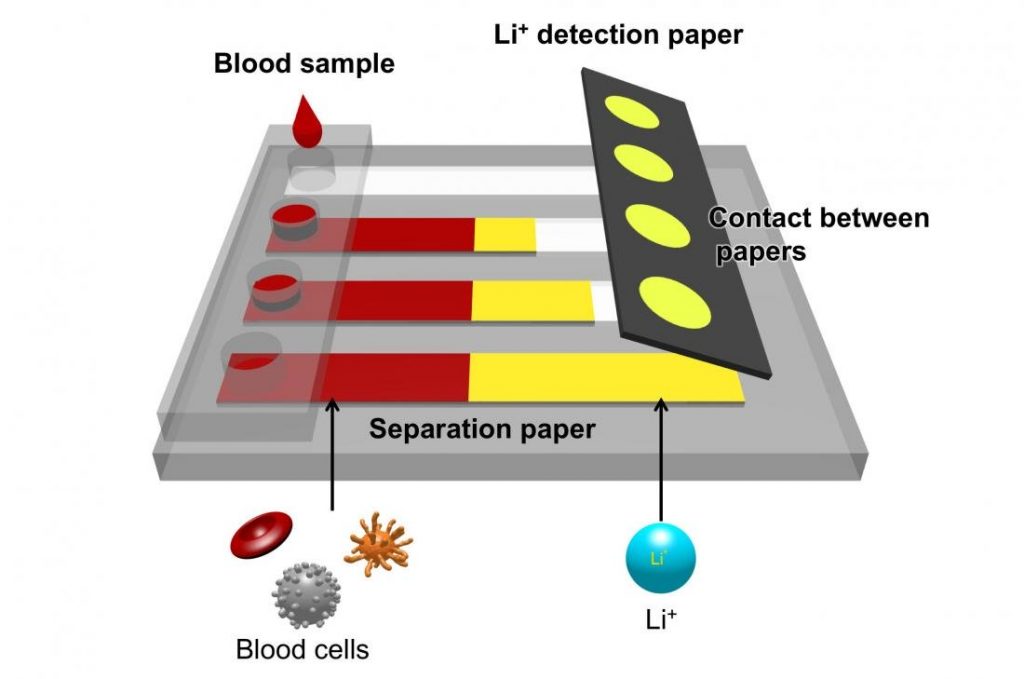 New device quickly detects lithium ions in blood of bipolar disorder patients 2 blood device