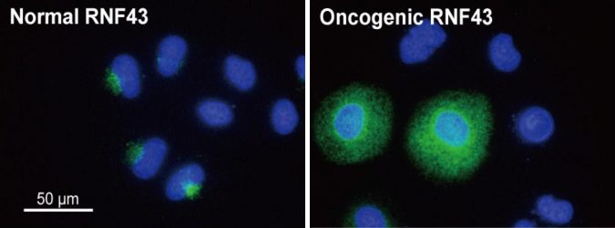 Scientists unraveled molecular mechanism behind colorectal cancer 2 colorectal cancer