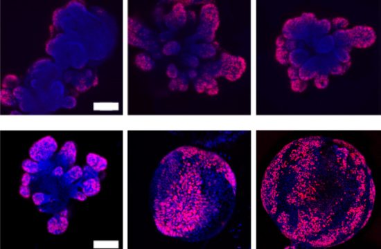 Cell Crowding 01 Press