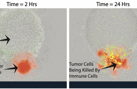 immune cells