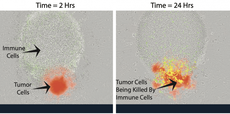 immune cells