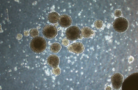 Sphere formation