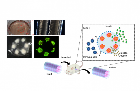 Type I Diabetes Mellitus