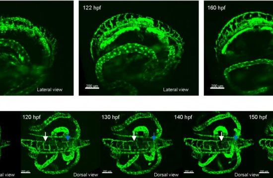 lymphatic vessel development