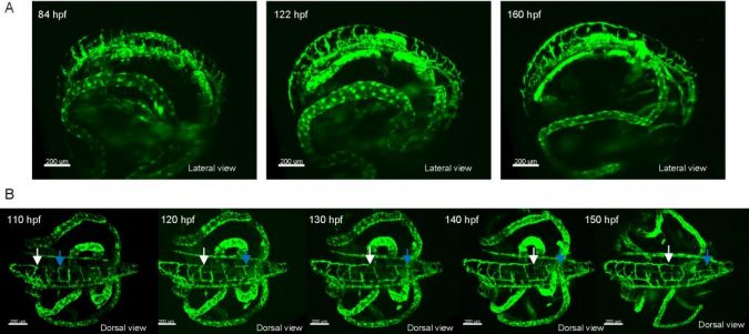 lymphatic vessel development