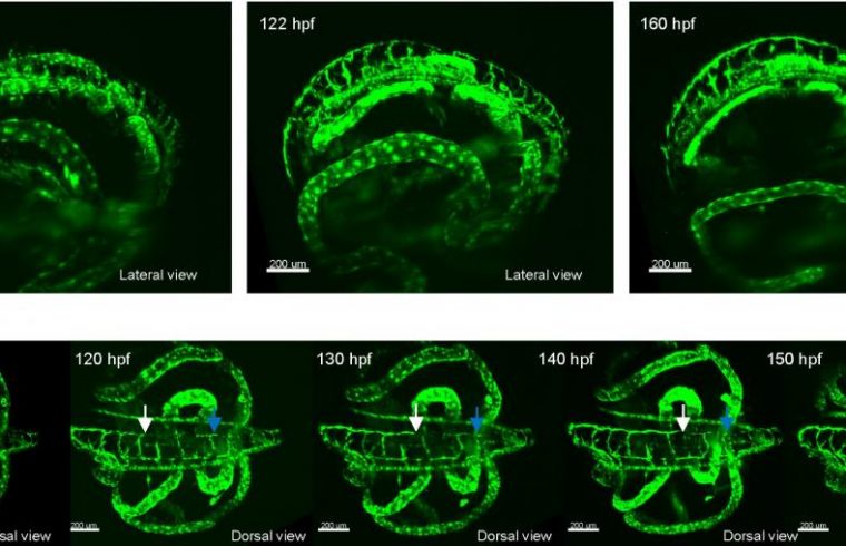 lymphatic vessel development