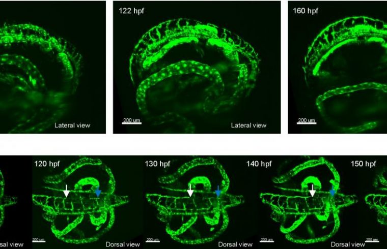 lymphatic vessel development