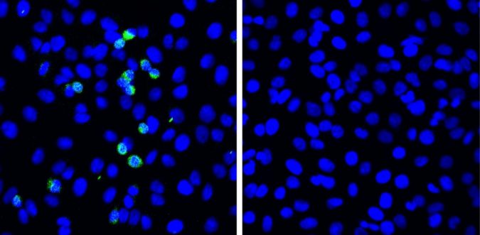 Novel defense mechanism for SARS-CoV-2 discovered 2 sars cov 2 virtal sipike proteins green