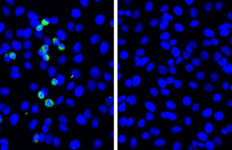 sars cov 2 virtal sipike proteins green