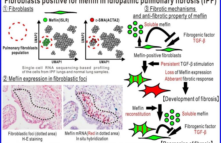 Fibroblasts