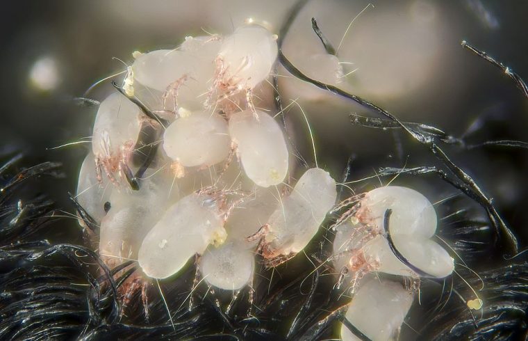 dust mites