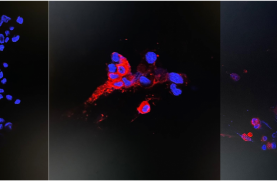 Immunofluorescence staining of uninfected and infected Vero E6 cells