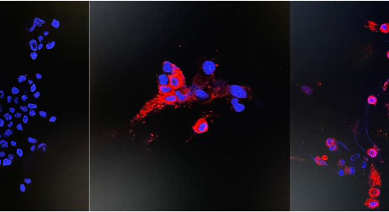 Immunofluorescence staining of uninfected and infected Vero E6 cells