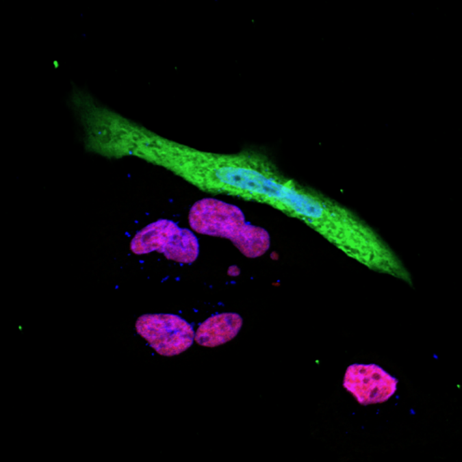 How SARS-CoV-2 evades our immune system 2 immune responce gene