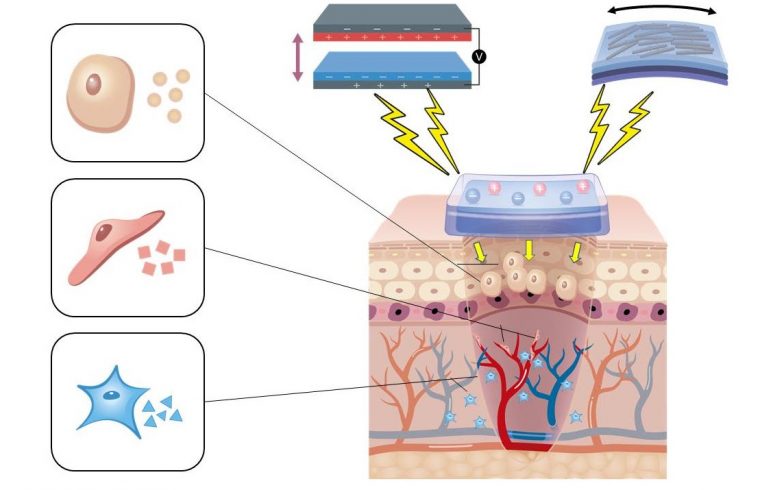 wound healing