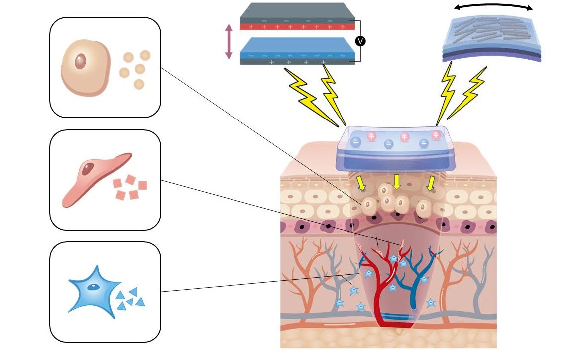 Tiny electric generators could accelerate wound healing