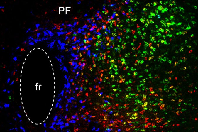 Three distinct brain circuits in the thalamus contribute to Parkinson’s symptoms 2 MIT Park Circuits 01 press