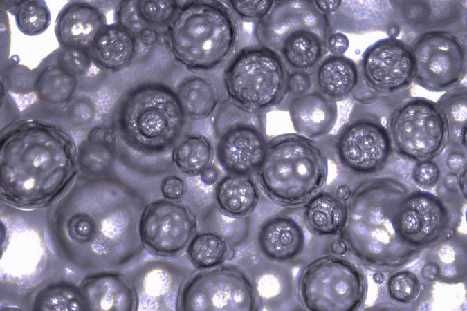 Could carbon monoxide foam help fight inflammation? 2 Carbon Monoxide 01 PRESS 0
