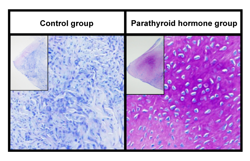 Tendon tissue plus parathyroid hormone reproduce a normal…