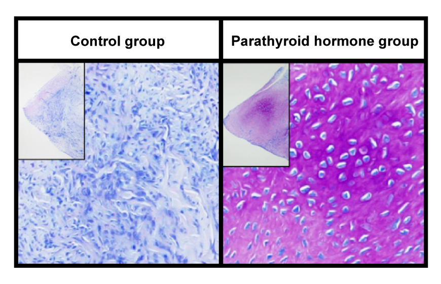 Tendon tissue plus parathyroid hormone reproduce a normal meniscus