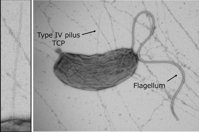 Transmission electron micrograph of Vibrio cholerae strain O395