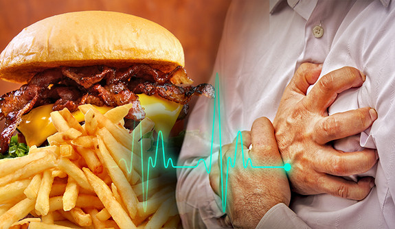 Five billion people are unprotected from trans fat leading to heart disease