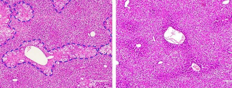 New drug delivery system delivers an antioxidant directly to liver mitochondria