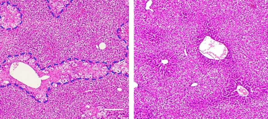 New drug delivery system delivers an antioxidant directly to liver mitochondria