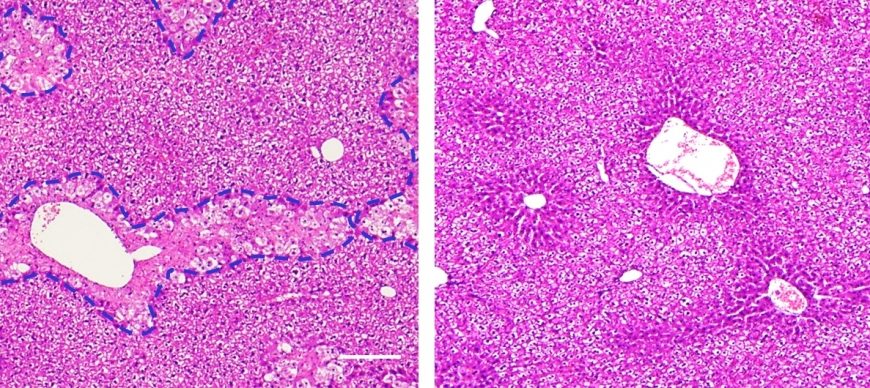 New drug delivery system delivers…