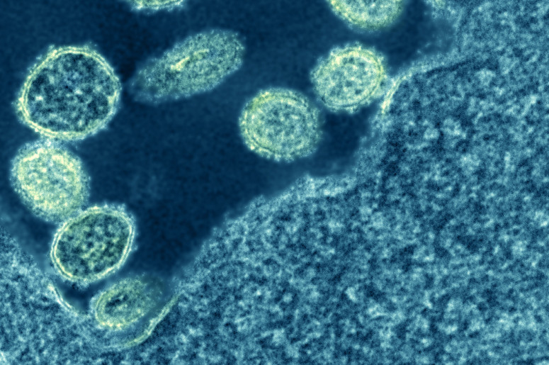 UW–Madison researchers reveal how key protein might help influenza A infect its hosts