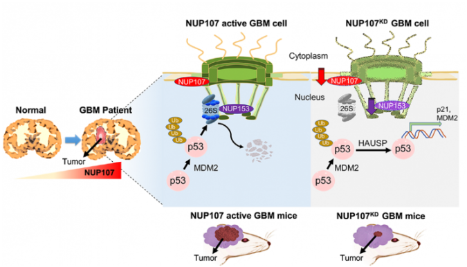 Research shows brain cancer linked to nuclear pore alterations 2 brain cancer linked