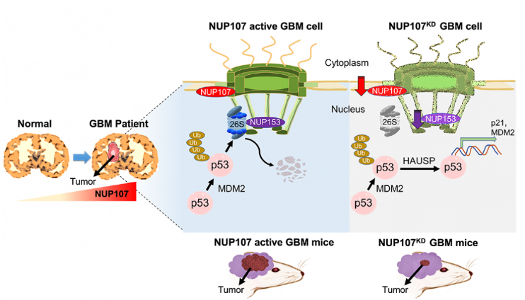 Research shows brain cancer linked to nuclear pore alterations