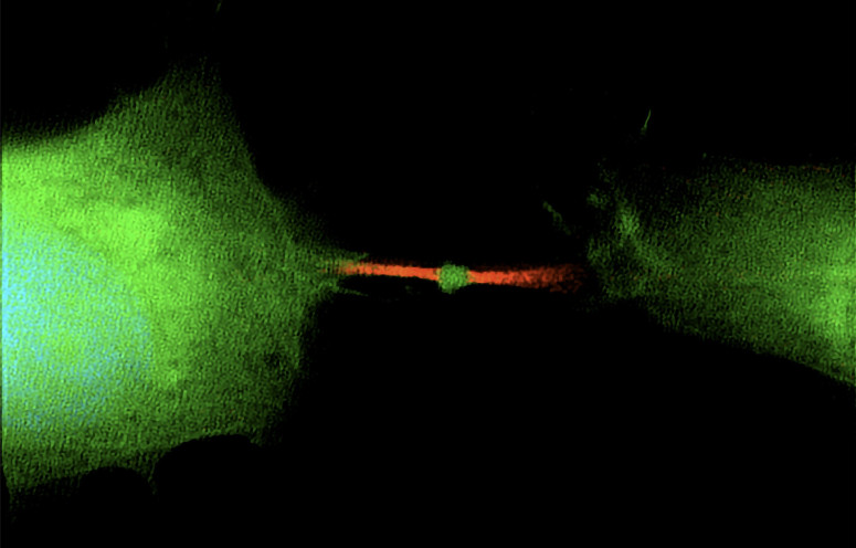 Remnant cell division could be responsible for spreading…