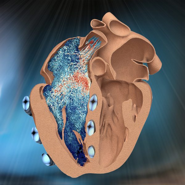 MIT engineers design a robotic replica of the heart’s right chamber 