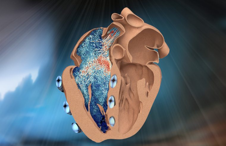 Right Heart