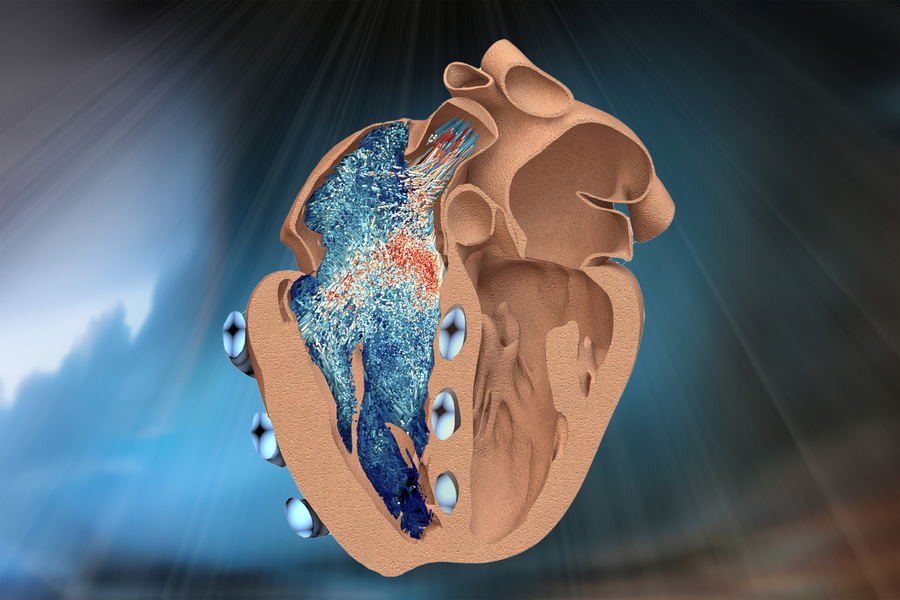 MIT engineers design a robotic replica of the heart’s right chamber 