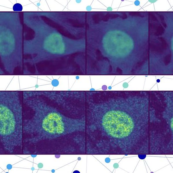 With AI, researchers predict the location of virtually any protein within a human cell