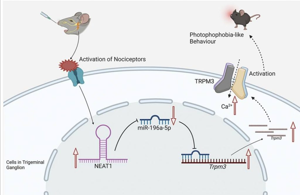 New insights into migraine-related light sensitivity 2 NEAT1