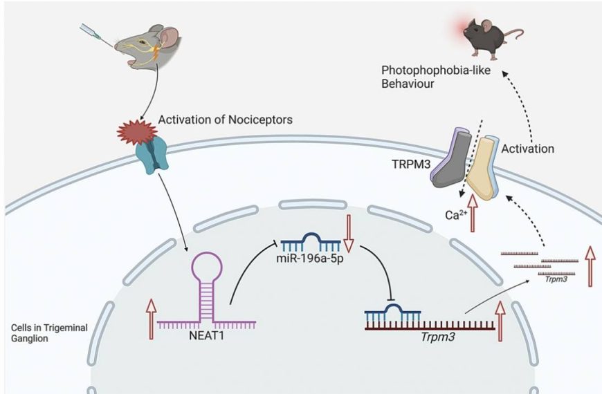 New insights into migraine-related light sensitivity