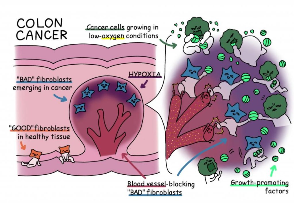 healthy colon tissue