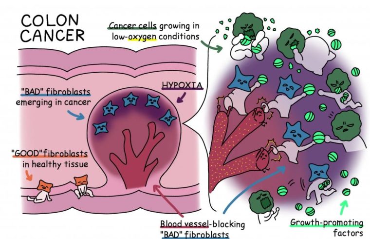 healthy colon tissue