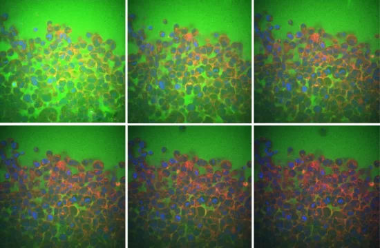 MIT Cell Water Eflux 01 Press 1