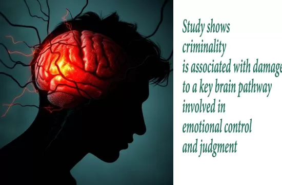 brain and crime study