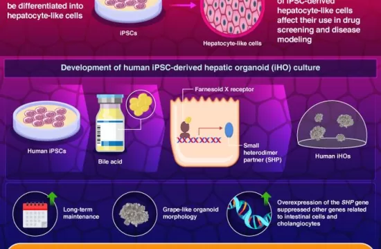 Low Res Infographic